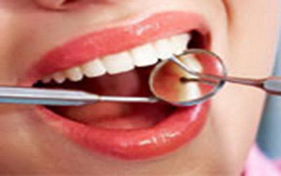 补牙过程是什么感觉