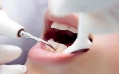 成年人牙齿如何保养_不同部位的牙齿图片