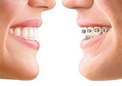 根管治疗的牙齿咬合疼_根管治疗的牙齿要钻几次