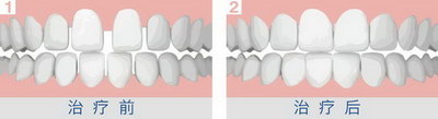 儿童牙齿发育对照表_儿童牙齿发育过程图