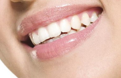 30岁矫正牙齿要多久才能看到效果(牙套要带多久才能矫正牙齿)