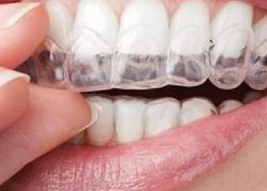 牙齿两年后可以种牙吗