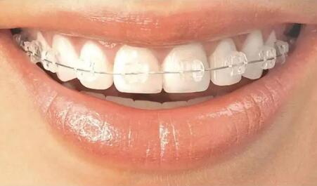 先天性缺牙没有牙胚_半口缺牙装什么牙好