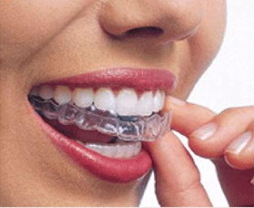 刷牙可不可以使牙齿由黄变白_刷牙可以去除牙齿黑色的污垢