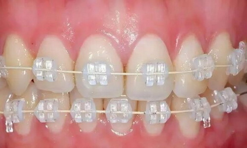 北京较好的牙科是哪家_南充比较好一点的牙科