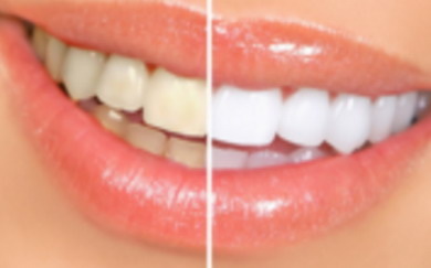 拔牙后三个星期可以种牙齿吗_拔牙后需要多长时间可以种牙齿
