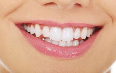 成人牙齿矫正大概要多久_成人牙齿矫正的最晚年龄段