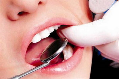 14个月牙齿发育标准(月龄与牙齿发育)