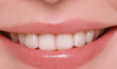 呼和浩特义齿加工厂有哪些_吸附性义齿是什么材质做的
