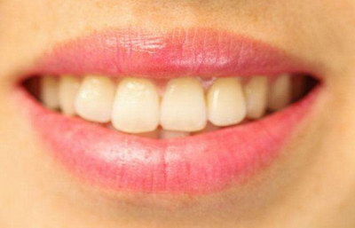 凹进去的牙齿叫什么_牙齿坏了补钙有用吗