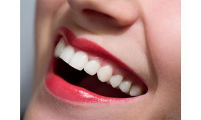 拔牙有哪些副作用_拔牙后多久能健身