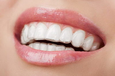 根管治疗后牙齿劈裂看哪一个科_根管治疗后牙齿侧面掉了一小块