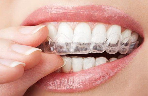 补牙填充物多长时间能好_补牙的水银会慢慢损耗吗