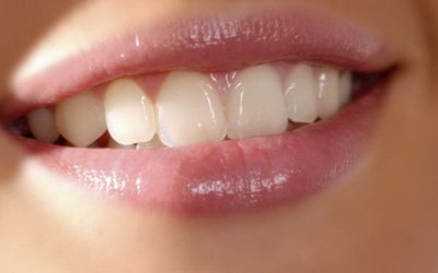 刷牙时牙龈长期出血怎么治疗_刷牙时牙龈总是出血怎么回事