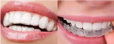 做磁共振有假牙有什么影响_做活动的假牙对牙有影响吗