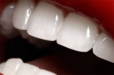 双氧水洗牙的作用及其益处【双氧水洗牙龈变白】