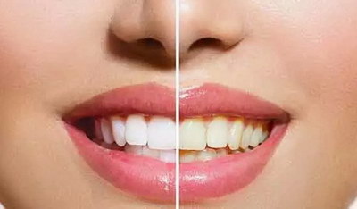 补牙之后牙酸是什么原因