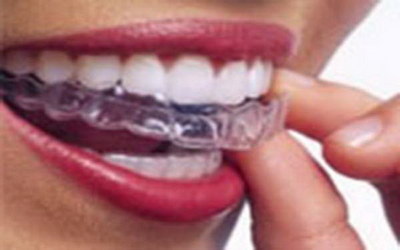 牙龈肿总出血是什么原因(牙肉肿牙龈出血是什么原因)