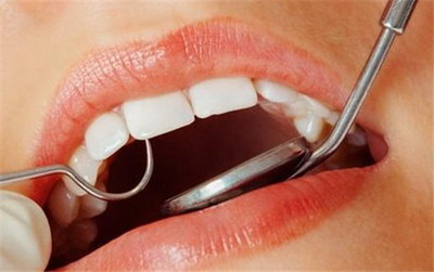 拔智齿以后多久可以刷拔牙那一边_拔智齿以后多久可以刷伤口附近的牙