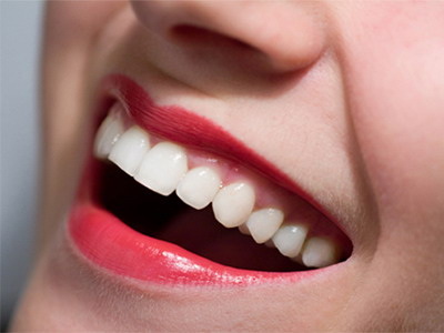 做完根管治疗牙齿敏感
