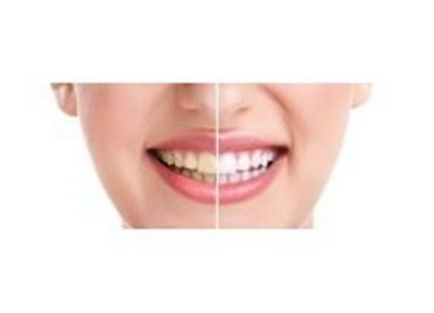 先天性牙根缺失怎么治疗
