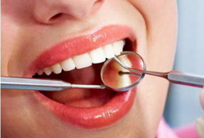 根管治疗后的牙齿适合整牙吗