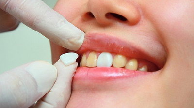 拔牙后洞多久牙龈能长平