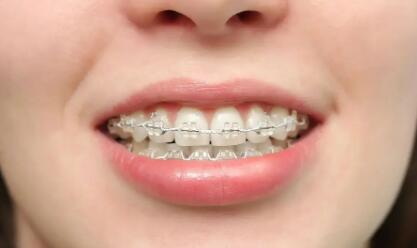 全口牙磕断一半怎样修复