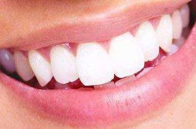 美国3m纳米树脂补牙可以用多久