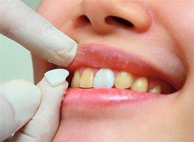 补完牙后吃东西牙齿酸痛_补完牙后吃东西牙疼正常吗