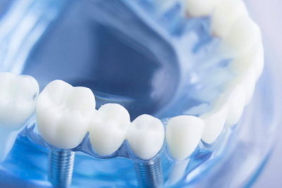 补完烂牙牙齿痛是什么回事_补完牙齿后旁边的牙齿痛
