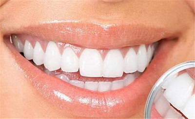 拔牙后多久可以正常刷牙_拔牙后多久可以正常刷牙洞