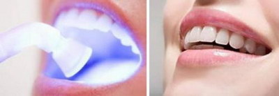 全口种植牙是什么样的牙_全口种植牙的危害有哪些