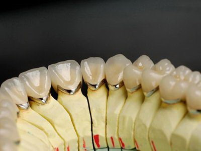 为什么感觉牙齿有点松动_戴保持器会使牙齿松动吗