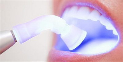 戴牙套的牙齿里面酸痛怎么办_戴牙套的第一天牙齿咬不下去