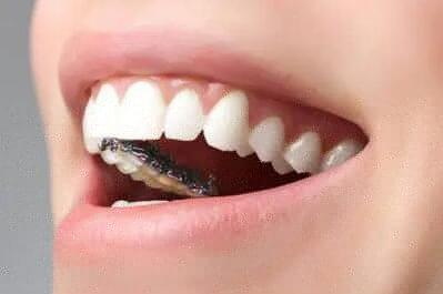 拔牙后舌头发黑怎么回事_拔牙后舌头发麻是什么原因