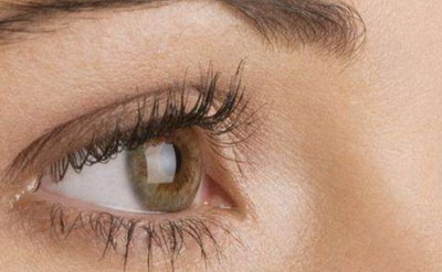 全切双眼皮疤痕增生期是多久_全切双眼皮疤痕增生多久可以变平