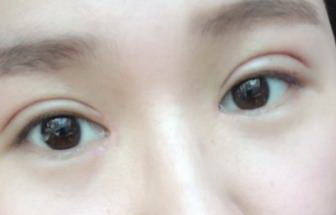 画眼影眼皮眼窝位置图解_眼皮变多层是什么原因