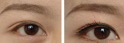 右眼黑眼圈比左眼严重是怎么了_怎么去除眼袋和黑眼圈最快方法