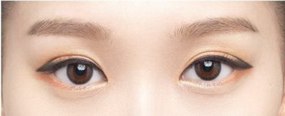割双眼皮眼综合是什么意思_眼综合和割双眼皮有什么区别