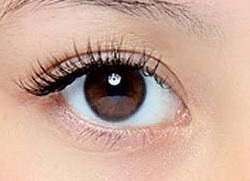 双眼皮通常做几毫米的_割完双眼皮眼皮上面肿