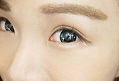 眼袋和黑眼圈的人区别图片_长期的黑眼圈和眼袋怎么去除