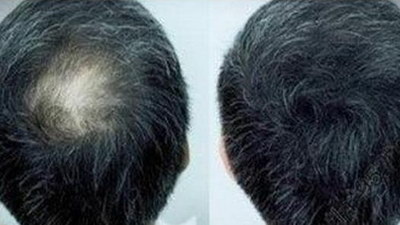 6个月头发可以长多长_橄榄油直接涂在头发上