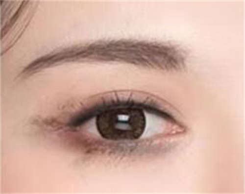 南阳市唐河县手术去黑眼圈整形科价格表明细新版出炉?手术去黑眼圈费用具体是多少?