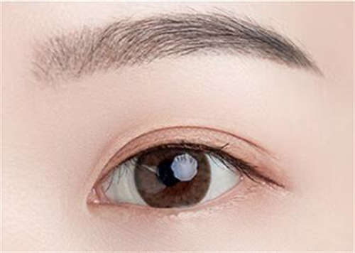听说韩式双眼皮效果挺好的，我想问一下，我这种一单一双的眼皮可以做韩式双眼皮吗？「双眼皮手术后有淤血怎么办呢」