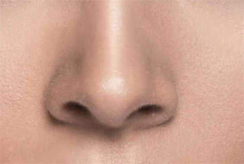 鼻综合维持多久_鼻综合多久可以修复?